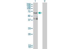 Western Blot analysis of ETV4 expression in transfected 293T cell line by ETV4 monoclonal antibody (M01), clone 3G9-1B9. (ETV4 antibody  (AA 1-207))