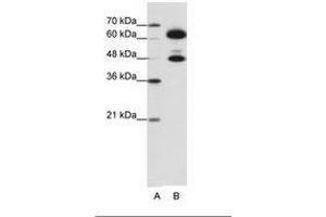 Image no. 1 for anti-Small Nuclear Ribonucleoprotein 70kDa (U1) (SNRNP70) (AA 301-350) antibody (ABIN6736194)