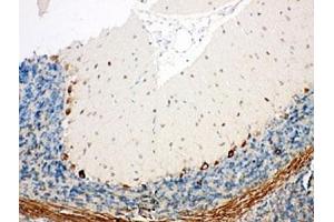 Immunohistochemistry (IHC) image for anti-Signal Sequence Receptor gamma (SSRg) (AA 8-23) antibody (ABIN3032563)