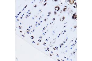 Immunohistochemistry of paraffin-embedded Rat leg bone using PTH1R Rabbit pAb (ABIN3022477, ABIN3022478, ABIN3022479, ABIN1513445 and ABIN6218844) at dilution of 1:100 (40x lens). (PTH1R antibody  (AA 464-593))