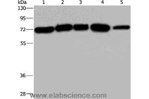 Western blot analysis of A172, Hela and 293T cell, K562 cell and human testis tissue, using AGFG1 Polyclonal Antibody at dilution of 1:533