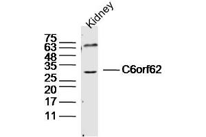 Mouse kidney lysates probed with C6orf62 Polyclonal Antibody, Unconjugated  at 1:300 dilution and 4˚C overnight incubation. (C6ORF62 antibody  (AA 1-100))