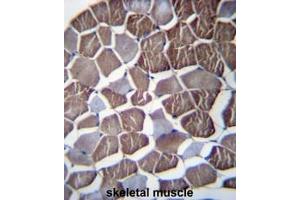 NPHP3 Antibody (N-term) immunohistochemistry analysis in formalin fixed and paraffin embedded human skeletal muscle followed by peroxidase conjugation of the secondary antibody and DAB staining.