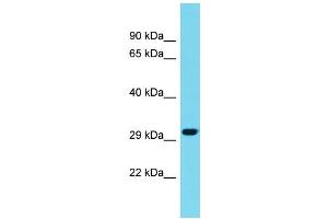 Host: Rabbit Target Name: METRNL Sample Type: Fetal Liver lysates Antibody Dilution: 1. (METRNL antibody  (C-Term))