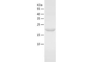 Western Blotting (WB) image for CTD Small Phosphatase-Like Protein (CTDSPL) (AA 82-265) protein (His tag) (ABIN7284352) (CTDSPL Protein (AA 82-265) (His tag))
