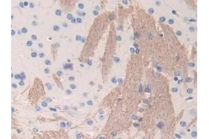 Detection of FGB in Mouse Cerebrum Tissue using Polyclonal Antibody to Fibrinogen Beta Chain (FGB) (Fibrinogen beta Chain antibody  (AA 35-481))