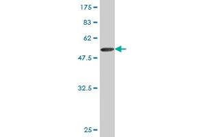 Western Blot detection against Immunogen (51. (TK1 antibody  (AA 1-234))