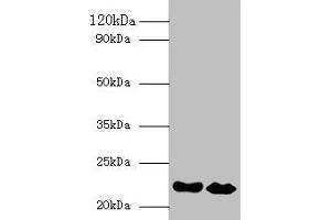 Western blot All lanes: IFNA21 antibody at 2 μg/mL Lane 1: NIH/3T3 whole cell lysate Lane 2: HepG2 whole cell lysate Secondary Goat polyclonal to rabbit IgG at 1/10000 dilution Predicted band size: 22 kDa Observed band size: 22 kDa (IFNA21 antibody  (AA 24-189))