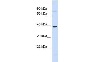 Host:  Rabbit  Target Name:  RHBDL2  Sample Type:  293T Whole Cell lysates  Antibody Dilution:  1.