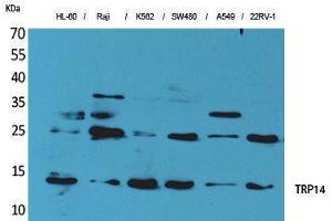 Western Blotting (WB) image for anti-Thioredoxin Domain Containing 17 (TXNDC17) (Tyr796) antibody (ABIN3187679) (TXNDC17 antibody  (Tyr796))