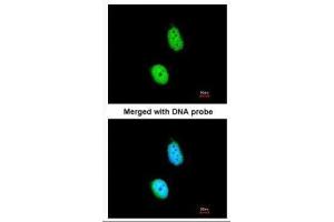 ICC/IF Image Immunofluorescence analysis of paraformaldehyde-fixed HeLa, using ERCC8, antibody at 1:200 dilution. (ERCC8 antibody  (Center))