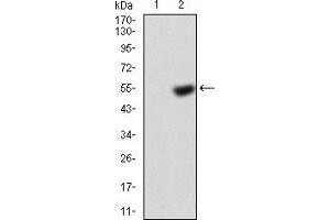 Western blot analysis using KBTBD8 mAb =against HEK293 (1) and KBTBD8 (AA: 264-464)-hIgGFc transfected HEK293 (2) cell lysate. (KBTBD8 antibody  (AA 264-464))