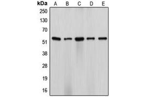 Western blot analysis of Cytochrome P450 17A1 expression in HeLa (A), NIH3T3 (B), H9C2 (C), SW13 (D), ES2 (E) whole cell lysates. (CYP17A1 antibody  (Center))
