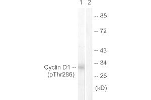 Western blot analysis of extracts from Jurkat cells, treated with EGF (200ng/ml, 30mins), using Cyclin D1 (Phospho-Thr286) antibody. (Cyclin D1 antibody  (pThr286))