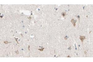 Immunohistochemistry (IHC) image for anti-Lemur tyrosine Kinase 2 (LMTK2) (Internal Region) antibody (ABIN6258874)