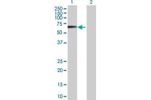 Western Blot analysis of STK38L expression in transfected 293T cell line by STK38L MaxPab polyclonal antibody. (STK38L antibody  (AA 1-464))