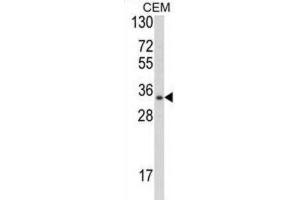 Western Blotting (WB) image for anti-Developmental Pluripotency Associated 4 (DPPA4) antibody (ABIN2997956) (DPPA4 antibody)