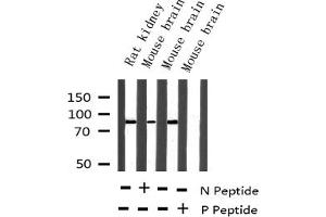 Western blot analysis of Phospho-Tau (Ser396) expression in various lysates
