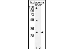 Western blot analysis of OR1D5 Antibody Pab pre-incubated without(lane 1) and with(lane 2) blocking peptide in human placenta tissue lysate.