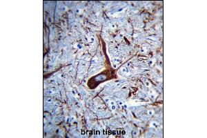 P2 Antibody (Ascites) ABIN659033 immunohistochemistry analysis in forlin fixed and paraffin embedded hun brain tissue followed by peroxidase conjμgation of the secondary antibody and DAB staining. (MAP2 antibody)