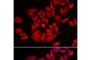 Immunofluorescence analysis of U2OS cells using TLK2 Polyclonal Antibody