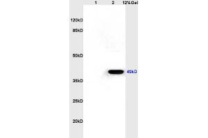 Lane 1: rat kidney lysates Lane 2: rat brain lysates probed with Anti CXCR1/IL-8RA Polyclonal Antibody, Unconjugated (ABIN730873) at 1:200 in 4 °C. (CXCR1 antibody  (AA 186-280))