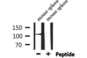 Western blot analysis of extracts from mouse spleen, using DPYD Antibody. (DPYD antibody  (Internal Region))