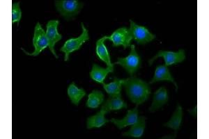 Immunofluorescence (IF) image for anti-TELO2 Interacting Protein 2 (TTI2) (AA 159-264) antibody (ABIN7171705)