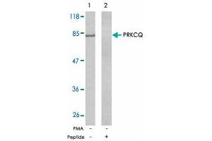 Western blot analysis of exreacts from Jurkat cells untreated or treated with PMA (1 ng/mL, 5 min) using PRKCQ polyclonal antibody .