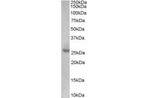 Western Blotting (WB) image for anti-Cyclin-Dependent Kinase Inhibitor 1B (p27, Kip1) (CDKN1B) (Internal Region) antibody (ABIN2465872) (CDKN1B antibody  (Internal Region))