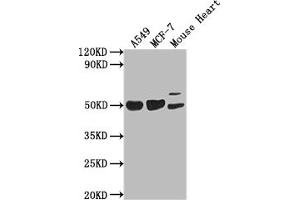 Western Blot Positive WB detected in: A549 whole cell lysate, MCF-7 whole cell lysate, Mouse Heart tissue All lanes: SRGAP2B antibody at 1:2000 Secondary Goat polyclonal to rabbit IgG at 1/50000 dilution Predicted band size: 54 kDa Observed band size: 54 kDa (SLIT-ROBO rho GTPase Activating Protein 2B (SRGAP2B) (AA 79-150) antibody)