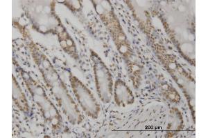 Immunoperoxidase of monoclonal antibody to AKT2 on formalin-fixed paraffin-embedded human small Intestine. (AKT2 antibody  (AA 100-189))