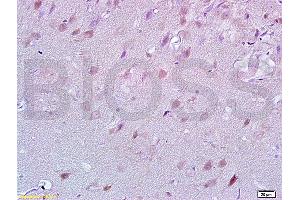 Formalin-fixed and rat brain tissue labeled with Anti-Lingo-1 Polyclonal Antibody, unconjugated  (ABIN738801)  at 1: 200 followed by incubation with conjugated secondary antibody and DAB staining (LINGO1 antibody  (AA 521-620))