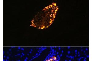 Immunofluorescence analysis of Rat pancreas using SST Polyclonal Antibody at dilution of 1:100 (40x lens). (Somatostatin antibody)