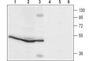 Western blot analysis of rat spleen (lanes 1 and4), rat pancreas (lanes 2 and 5) and mouse B-cell lymphoma (WEHI) (lanes 3 and 6) lysates: - 1-3. (ORAI1 antibody  (2nd Extracellular Loop))
