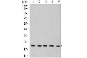 Western blot analysis using Rab6b mouse mAb against C6 (1), SK-N-SH (2), HT-29 (3), PC-12 (4), and C6 (5) cell lysate. (RAB6B antibody  (AA 95-208))