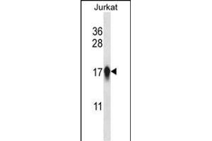 CEN Antibody (Center) (ABIN657764 and ABIN2846742) western blot analysis in Jurkat cell line lysates (35 μg/lane). (CENPA antibody  (AA 82-110))