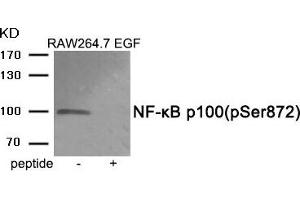 Western blot analysis of extracts from RAW264. (NFKB2 antibody  (pSer872))