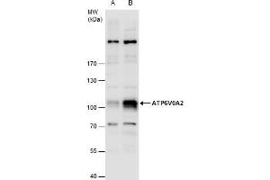 WB Image ATP6V0A2 antibody detects ATP6V0A2 protein by western blot analysis.