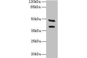 Western blot All lanes: CA12 antibody at 6 μg/mL + Mouse kidney tissue Secondary Goat polyclonal to rabbit IgG at 1/10000 dilution Predicted band size: 40, 39 kDa Observed band size: 40, 48 kDa (CA12 antibody  (AA 25-301))