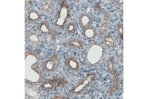 Immunohistochemical staining (Formalin-fixed paraffin-embedded sections) of human kidney with OCLN monoclonal antibody, clone CL1567  shows membranous positivity in renal tubules.