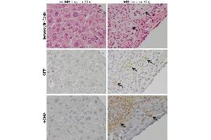 Immunohistochemistry (IHC) image for anti-Green Fluorescent Protein (GFP) antibody (ABIN100085)