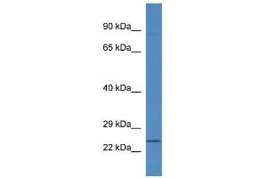 Western Blot showing Rnf183 antibody used at a concentration of 1. (RNF183 antibody  (N-Term))