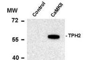 Image no. 1 for anti-Tryptophan Hydroxylase 2 (TPH2) (pSer19) antibody (ABIN372731) (Tryptophan Hydroxylase 2 antibody  (pSer19))