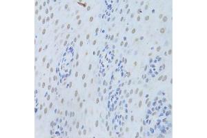 Immunohistochemistry (Paraffin-embedded Sections) (IHC (p)) image for anti-Heterogeneous Nuclear Ribonucleoprotein K (HNRNPK) (AA 1-280) antibody (ABIN3022414)