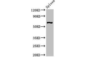 Western Blot Positive WB detected in: Mouse spleen tissue All lanes: CNKSR3 antibody at 2 μg/mL Secondary Goat polyclonal to rabbit IgG at 1/50000 dilution Predicted band size: 62, 101, 93 kDa Observed band size: 62 kDa (CNKSR3 antibody  (AA 301-555))