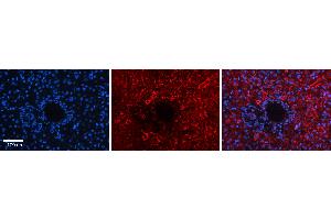 Rabbit Anti-DNAJB12 Antibody   Formalin Fixed Paraffin Embedded Tissue: Human Liver Tissue Observed Staining: Cytoplasm in hepatocytes Primary Antibody Concentration: 1:100 Other Working Concentrations: 1:600 Secondary Antibody: Donkey anti-Rabbit-Cy3 Secondary Antibody Concentration: 1:200 Magnification: 20X Exposure Time: 0. (DNAJB12 antibody  (Middle Region))