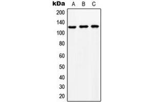Western blot analysis of NCKX1 expression in HeLa (A), SP2/0 (B), NIH3T3 (C) whole cell lysates. (SLC24A1 antibody  (Center))