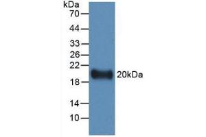 Western blot analysis of recombinant Human IL19. (IL-19 antibody  (AA 25-177))
