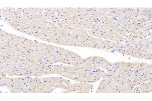 Immunohistochemistry (IHC) image for anti-Oxidized Low Density Lipoprotein (Lectin-Like) Receptor 1 (OLR1) (AA 57-270) antibody (ABIN7434209)